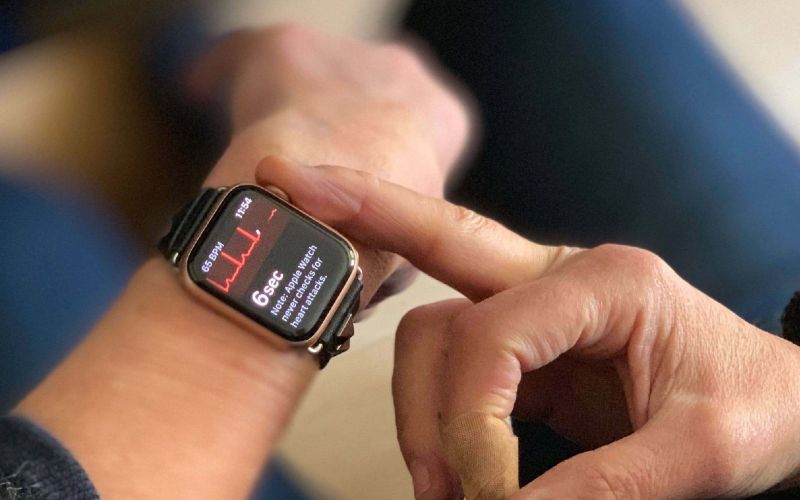 Apple Watch врятували мотоцикліста - годинник зателефонував в швидку і написав його дівчині